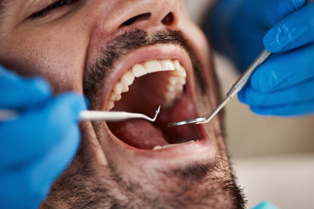 Best Emergency Tooth Extraction in Somers, WI